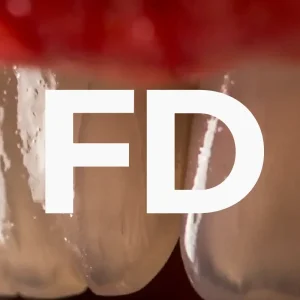 CURSO DE FOTOGRAFÍA DENTAL